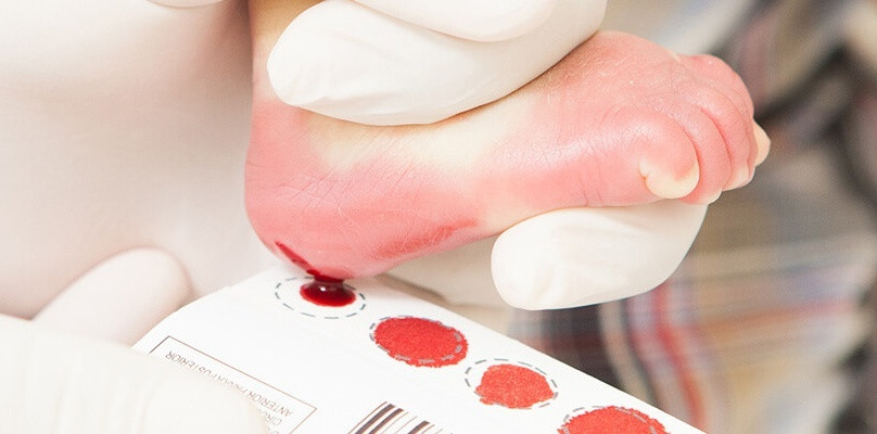 Teste do pezinho: saiba o que pode ocorrer se a criança não fizer o exame