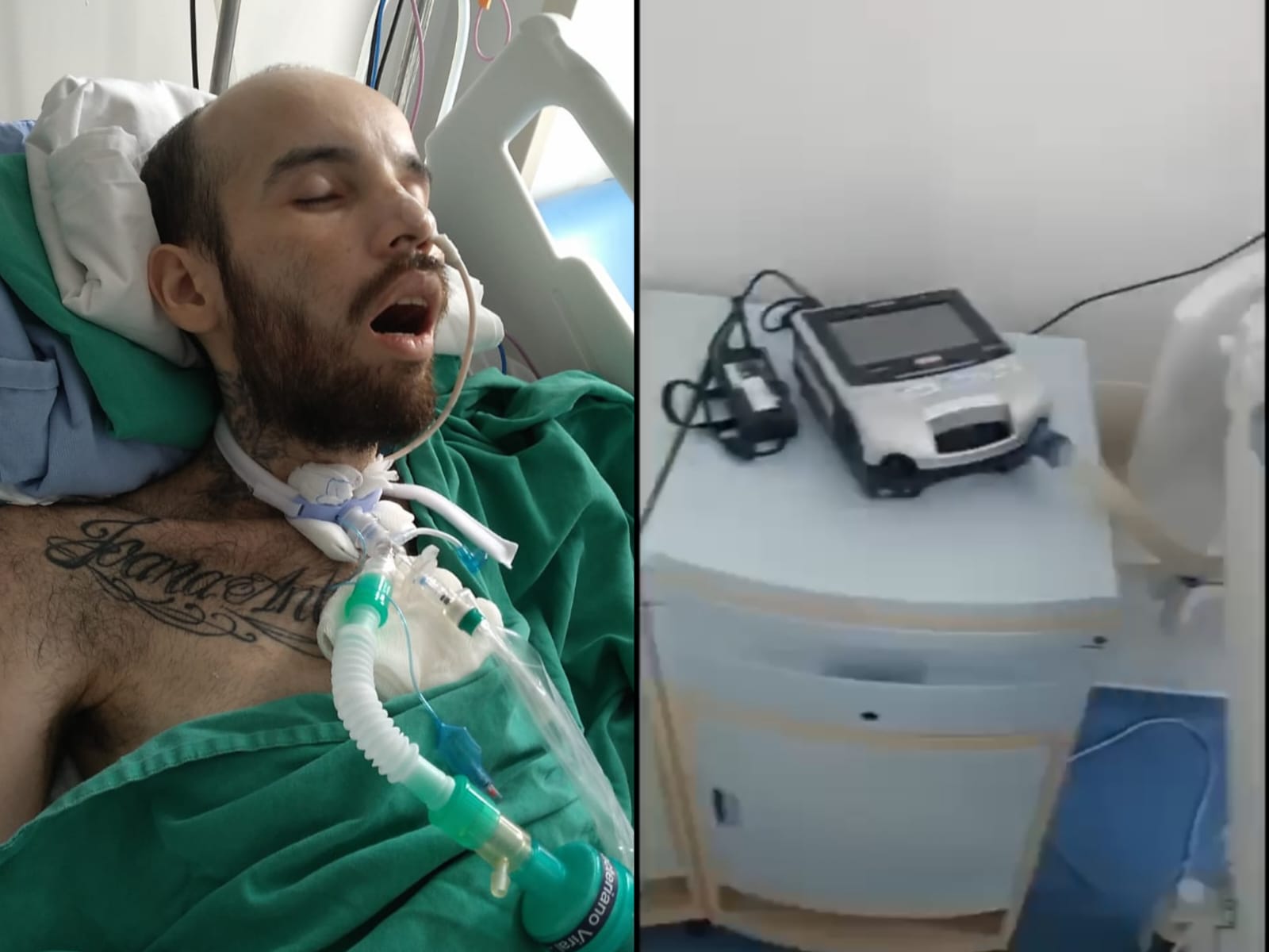 Após grave acidente, jovem fica tetraplégico e precisa de R$ 80 mil para montar UTI em casa