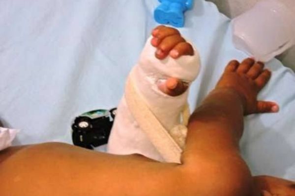 Crueldade: mãe é presa suspeita de deslocar braços de recém-nascido em Presidente Figueiredo