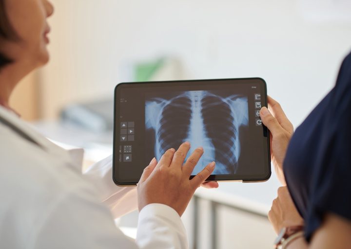Anvisa aprova medicamento para hipertensão pulmonar