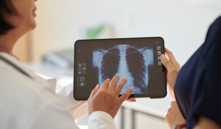Anvisa aprova medicamento para hipertensão pulmonar